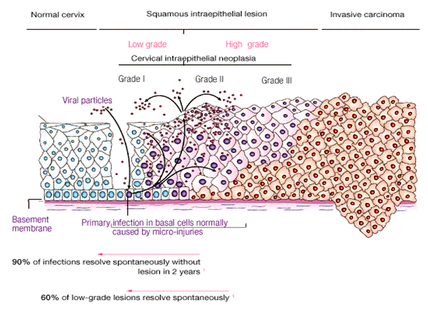 hpv3